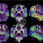 Учени от Йейл разкриха как стресът променя мозъка, за да направи спомените по силни